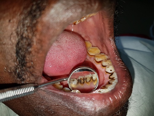 Dentysta Afryka