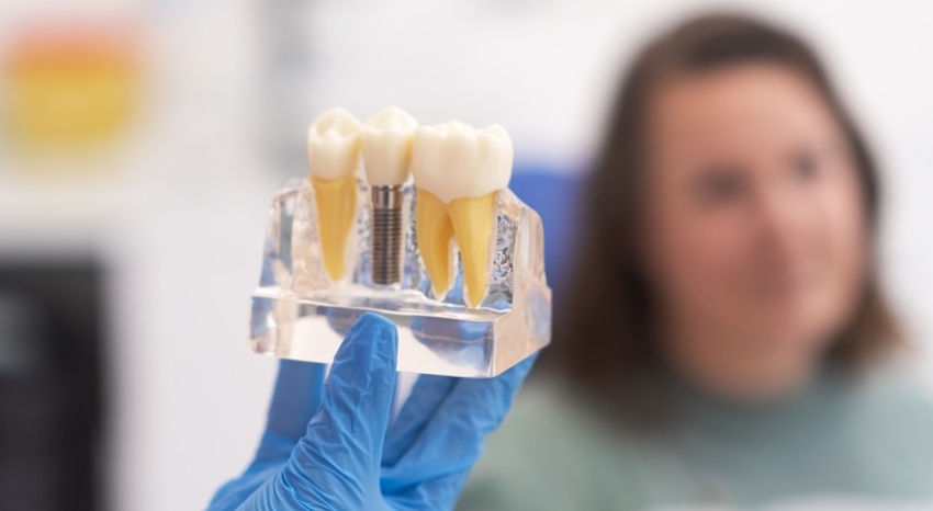 Implanty zębów – nie dla każdego. Jakie są przeciwwskazania do wszczepienia implantów zębowych?