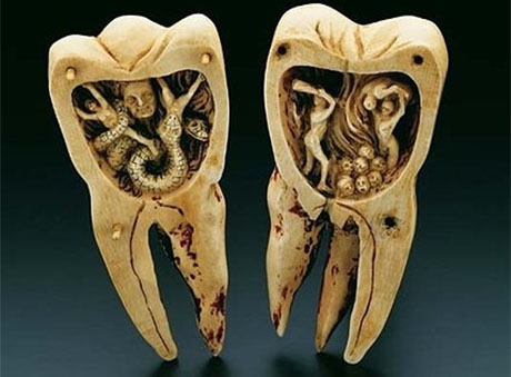 Przerażające robaki zębowe