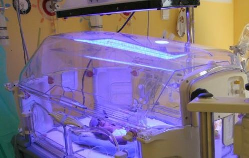 Olsztyn: operacja korekcji żuchwy u niemowlaka
