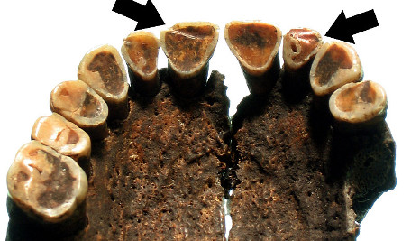 Dziwne ślady na zębach neolitycznych rolników