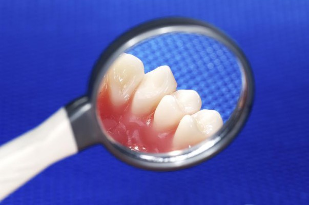 COVID-19: zły stan zdrowia jamy ustnej ozdrowieńców