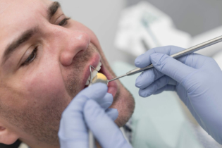 Ukruszony ząb - mężczyzna u dentysty podczas badania jamy ustnej