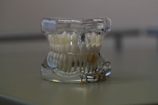 Dentonet - zastosowanie druku 3D w stomatologii