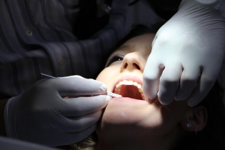 Co to jest fluoryzacja zębów - Dentonet.pl