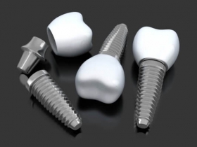 Dentonet - dlaczego implanty robi się z tytanu?