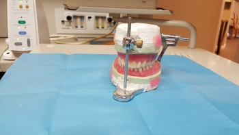 Ile kosztuje proteza zębowa - Dentonet.pl