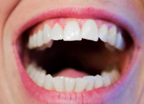 Choroby zębów - Dentonet.pl