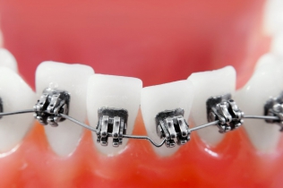 wizyta u ortodonty - Dentonet.pl