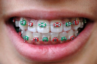 leczenie ortodontyczne - Dentonet.pl