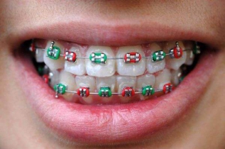 Na mocy decyzji Światowej Federacji Ortodontów (WFO) 15 maja br. po raz pierwszy obchodzony będzie Światowy Dzień Zdrowia Ortodontycznego - Dentonet.pl