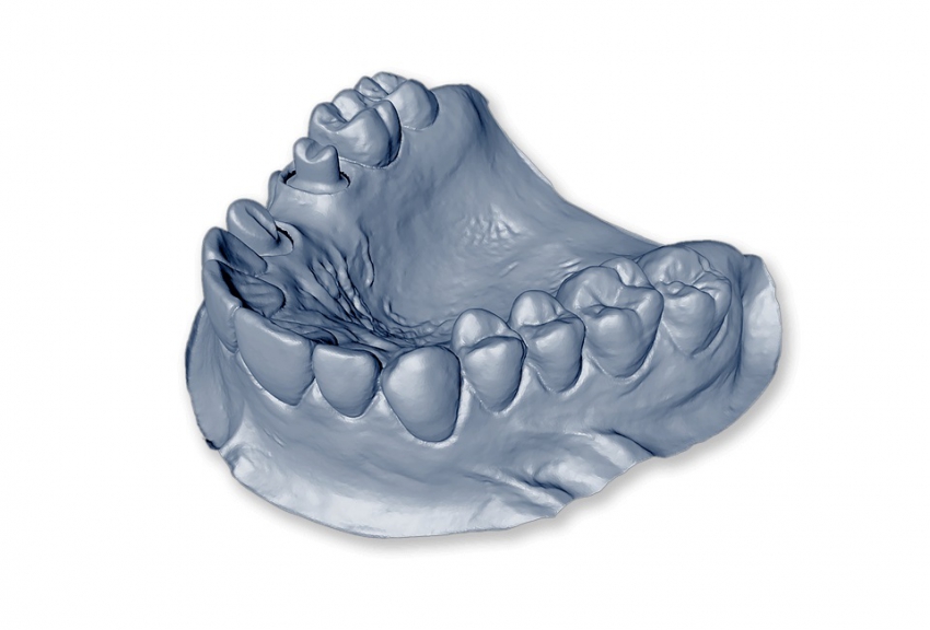 Zortrax chce drukować zęby, implanty i protezy zębowe
