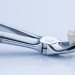 Suchy zębodół - usunięty zębodół w szczypcach dentystycznych