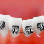 leczenie ortodontyczne - Dentonet.pl