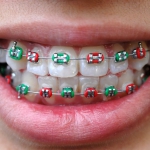 ortodoncja - Dentonet.pl