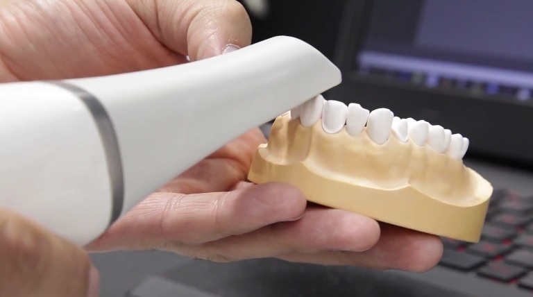 Spada zaufanie dentystów do nowoczesnych technologii?