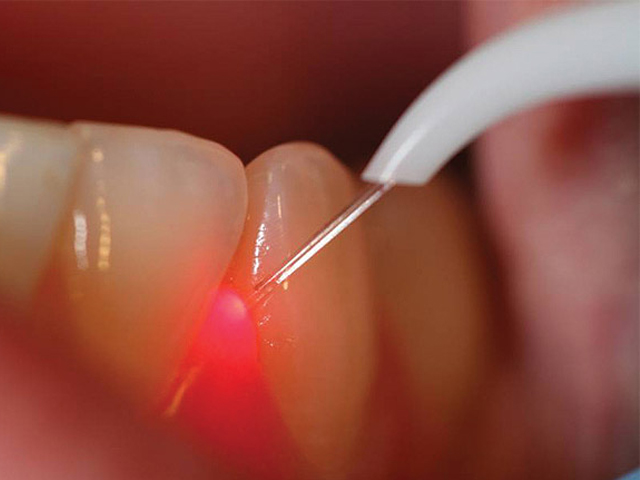 „Wykorzystanie laserów w stomatologii? Dentyści znają temat”