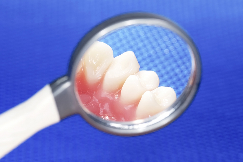 Hodowla ludzkich zębów z komórek macierzystych coraz bliżej?