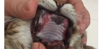 3. Jama ustna kota 14 dni po zabiegu pełnych ekstrakcji widoczny utrzymujący się jeszcze stan zapalny