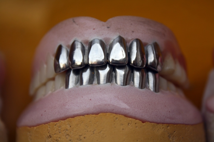 Wielka Brytania: znaleziono 200-letnią złotą protezę zębową