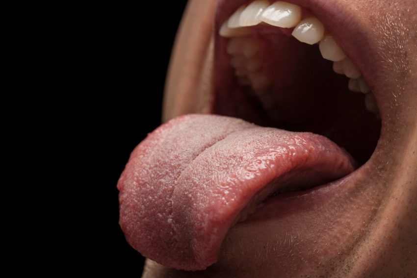 Autoamputacja języka – co każdy dentysta wiedzieć powinien?