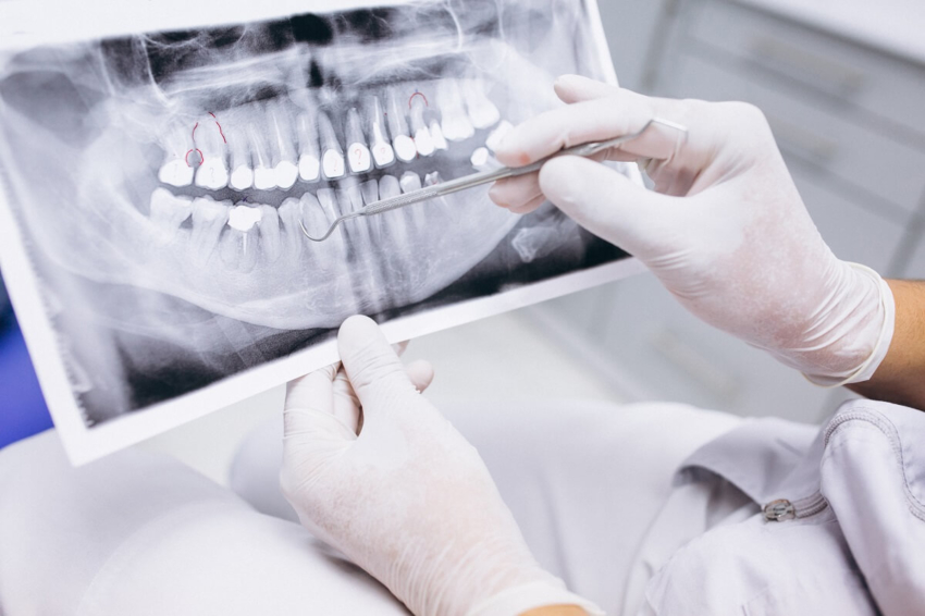 Szkocja: pandemia pogłębiła problemy z dostępem do dentysty