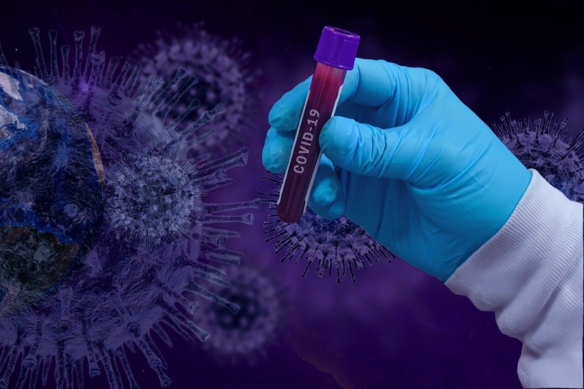 Obowiązkowe testy na koronawirusa nie dla medyków