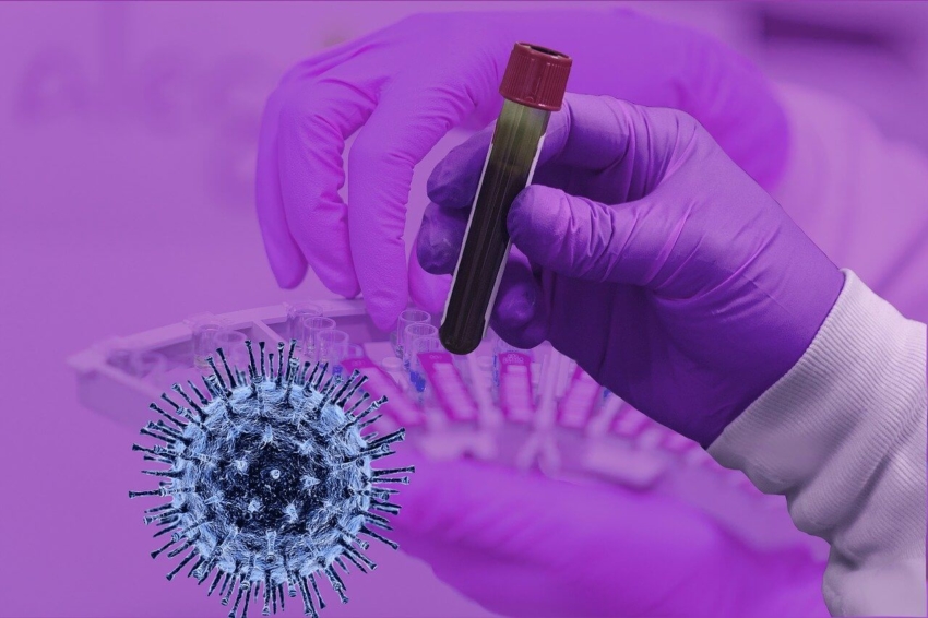 NRL apeluje: lekarze, zlecajcie wykonywanie testów na koronawirusa!