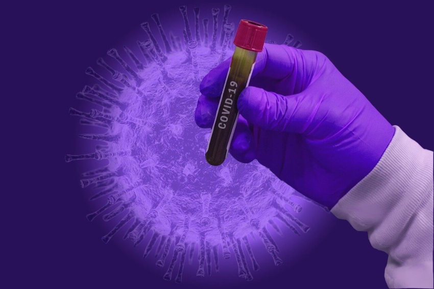 NFZ zapewni testy na SARS-CoV-2 dla personelu medycznego