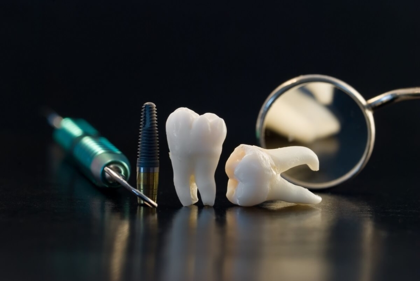 Australia: znikają ograniczenia w dostępie do stomatologów
