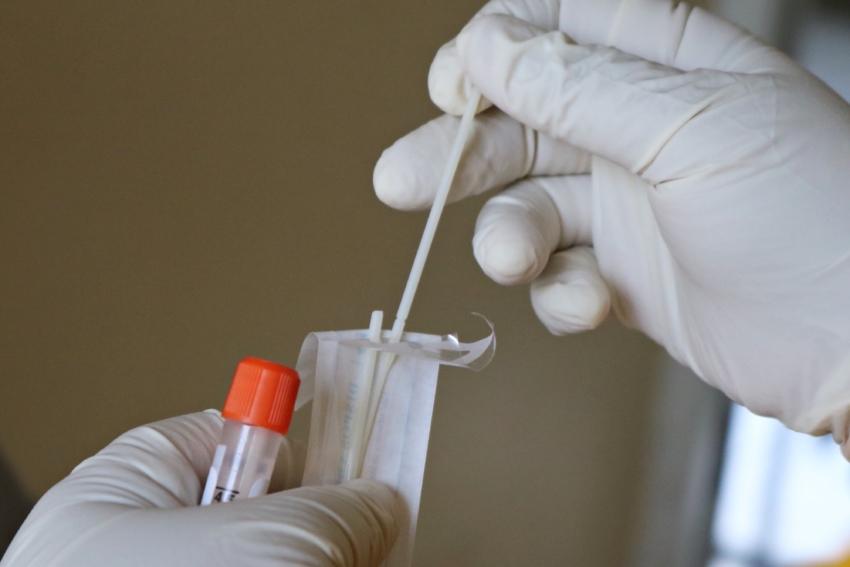 Światowa Organizacja Zdrowia: testy pozwalają na kontrolę pandemii