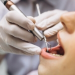 leczenie periodontologiczne - Dentonet.pl