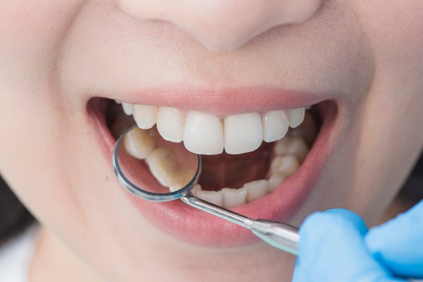 Asystowanie w zabiegach chirurgii periodontologicznej