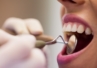 Jak zdrowie jamy ustnej wpływa na ogólny stan zdrowia?