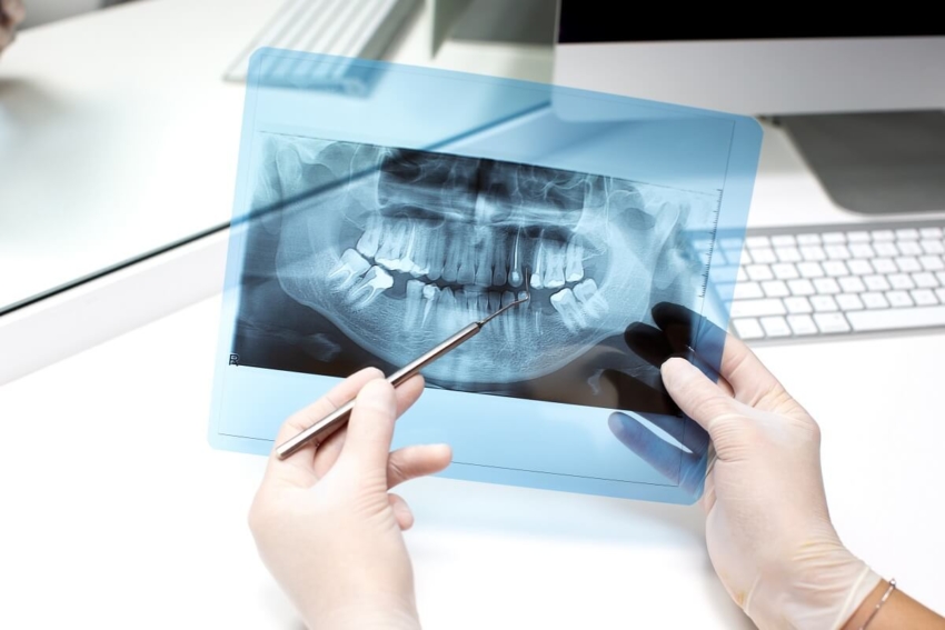 NIL: dodatkowy kurs z obrazowania 2D w stomatologii