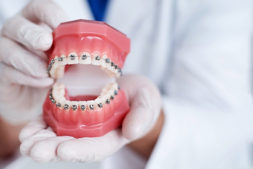 Co trzeci Brytyjczyk niebawem chce się leczyć ortodontycznie