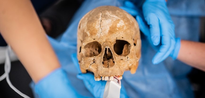 Badanie zębów sprzed 500 lat. „Praktycznie bez próchnicy”