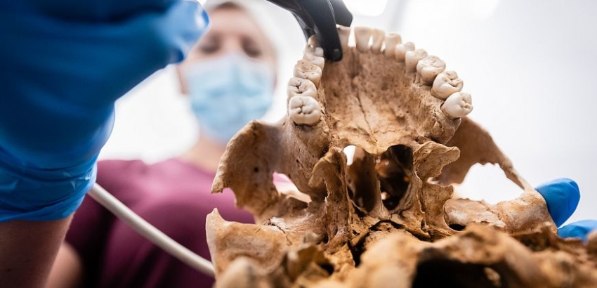 Zęby „wampirów” z Gliwic zbadane przez dentystów