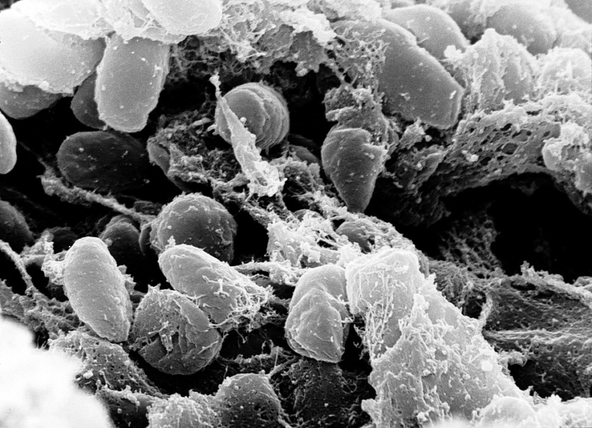 Ząb pomógł odkryć historię plagi dżumy w Europie w XIV wieku
