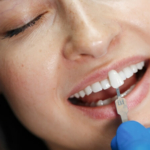 Licówki na krzywe zęby - dentysta przymierzający licówkę do zębów pacjentki
