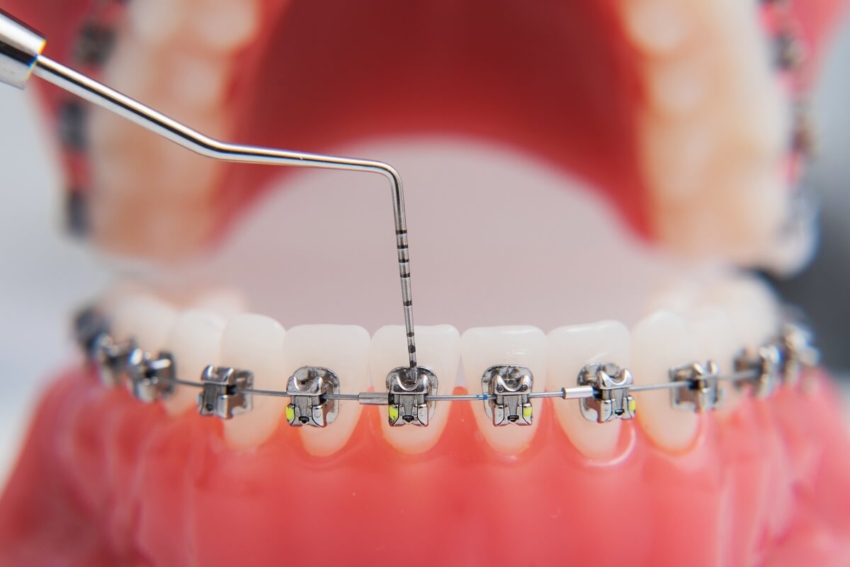 Dlaczego starożytni nie potrzebowali pomocy ortodonty?