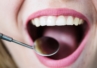 Patogeny jamy ustnej z czasem coraz bardziej oporne na antyseptyki?