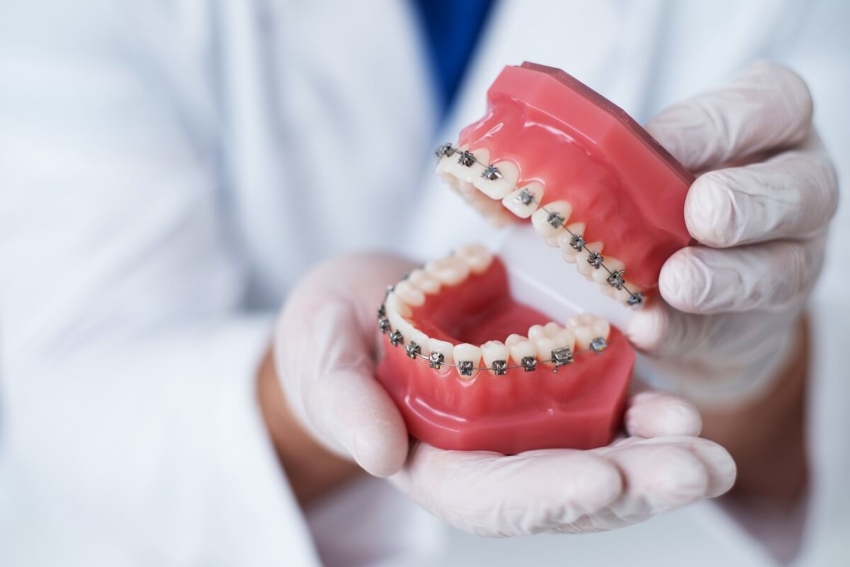 Barometr Watch Health Care: 11 miesięcy w kolejce do ortodonty