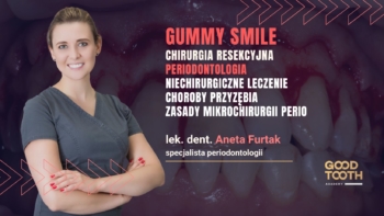 Gummy Smile - mikrochrurgiczne wydłużanie koron klinicznych w odcinku estetycznym