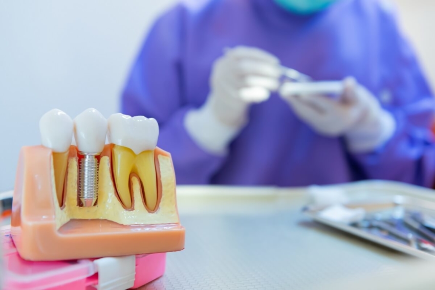 Wielka Brytania: rząd chce kształcić więcej dentystów