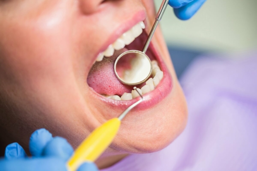 Ścieranie zębów coraz powszechniejsze u pacjentów