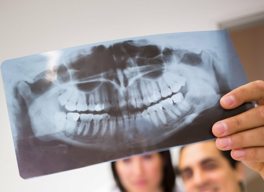 Czy ochrona przy RTG dentystycznym jest wciąż potrzebna?