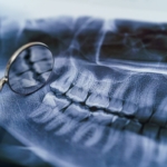 specjalizacje lekarsko dentystyczne