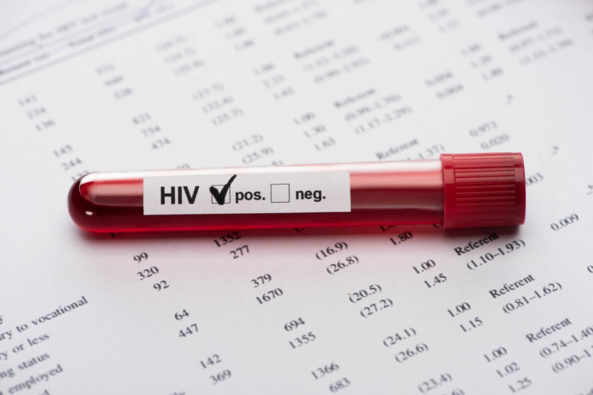 Co piąta osoba z wirusem HIV nie wie o swoim zakażeniu