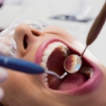 erytroleukoplakia jamy ustnej